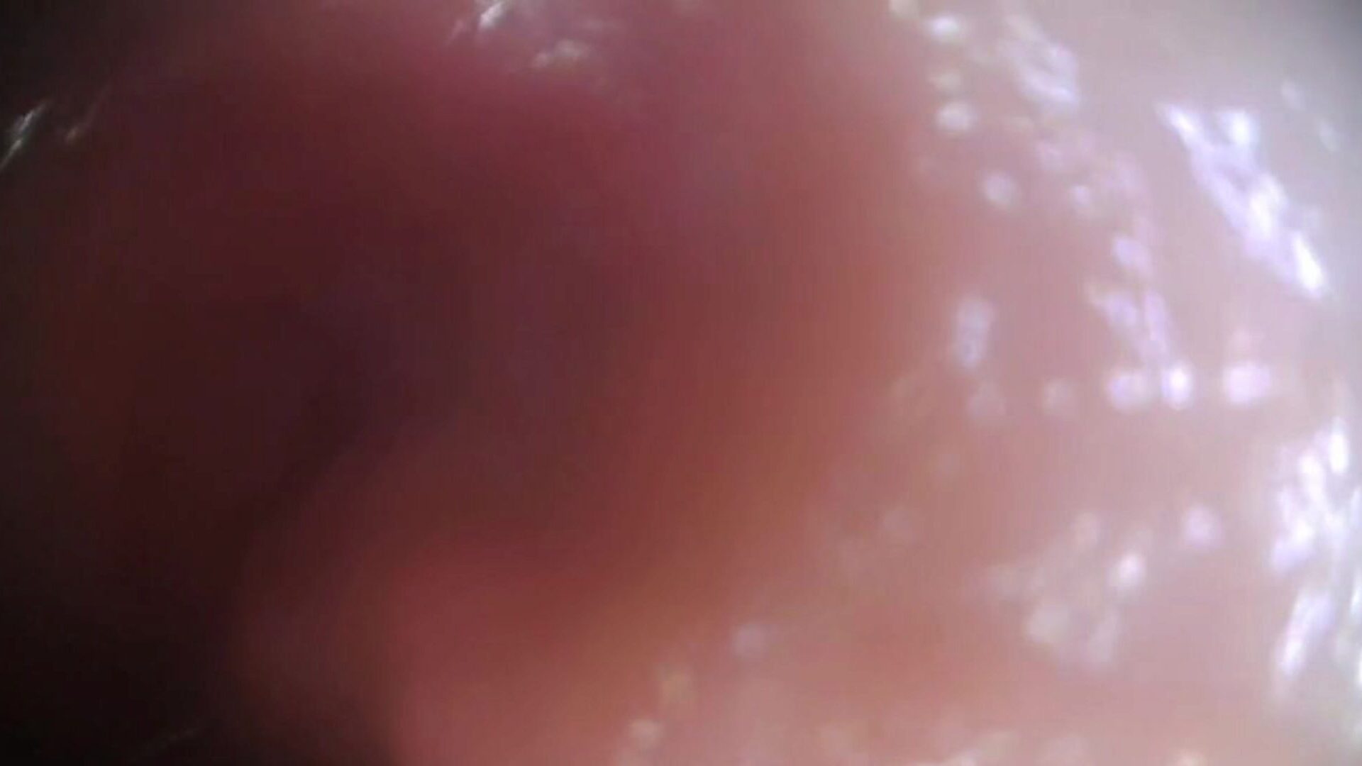 стварна сперма камера према унутра - оригинални цео видео